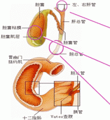 胆管结石的症状及早了解，及时发现病情