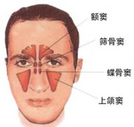 让鼻窦炎远离您的七项措施