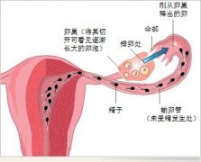 专家支招：6招助你预防卵巢“提早下岗”